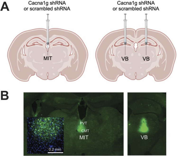 <i>In vivo</i> silencing of the thalamic Ca<sub>V</sub>3.1 voltage-gated calcium channels demonstrates their region-specific role in anesthetic mediated hypnosis.