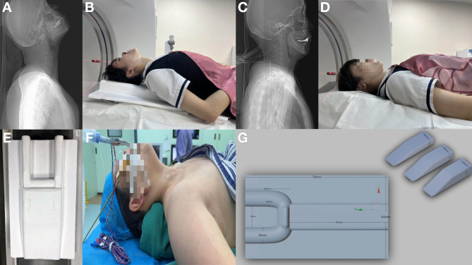 The impact of a simple positioning aid device on the diagnostic performance of thyroid cancer in CT scans: a randomized controlled trial.