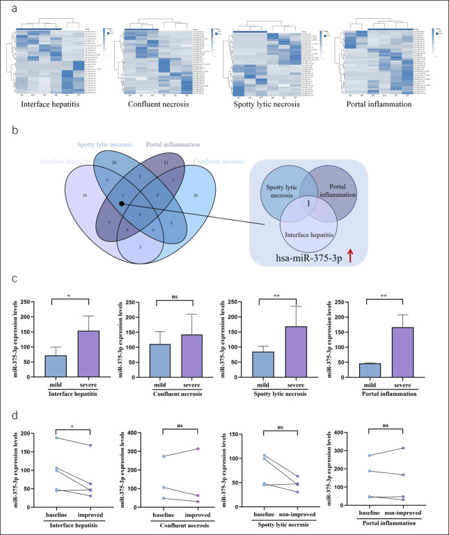 Downregulated Expression of Serum Exosome-Derived miR-375-3p Alleviates Interface Hepatitis and Promotes Fibrosis Regression in Patients With Chronic Hepatitis B.