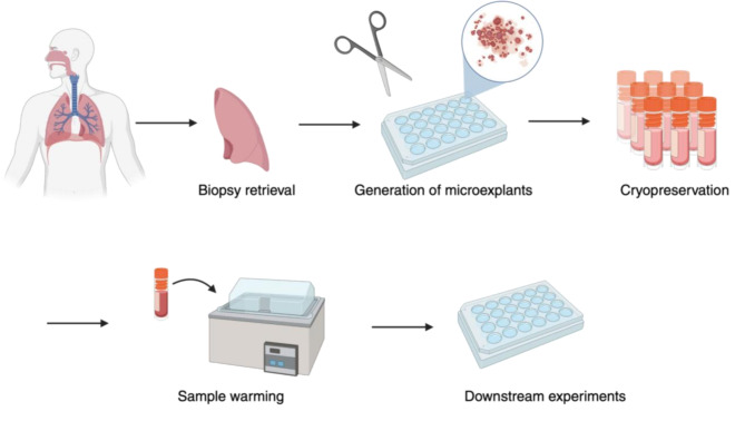 Cryopreservation of human lung tissue for 3D ex vivo analysis.