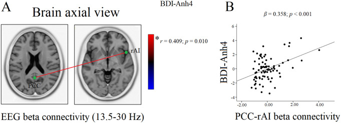 Severity of anhedonia is associated with hyper-synchronization of the salience-default mode network in non-clinical individuals: a resting state EEG connectivity study.