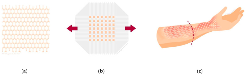 Wound and Short-Term Scar Outcomes of Meek Micrografting Versus Mesh Grafting: An Intra-Patient Randomized Controlled Trial.