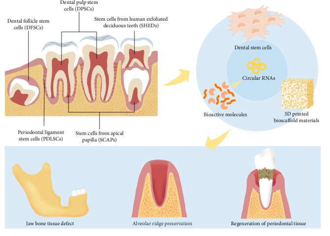 Impacts of Circular RNAs on the Osteogenic Differentiation of Dental Stem Cells.