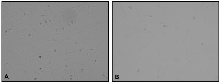 Safety and Efficacy of Pressurized Intra-Thoracic Aerosol Chemotherapy in Non-Small Cell Lung Cancer Pleural Carcinomatosis: Preliminary Results of a Pilot Study.