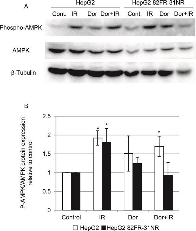Suppression of cancer stem-like cell radioresistance by inhibiting AMPK signaling.