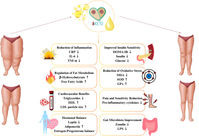 Therapeutic Applications of Ketogenic Diets in Lipedema: A Narrative Review of Current Evidence.