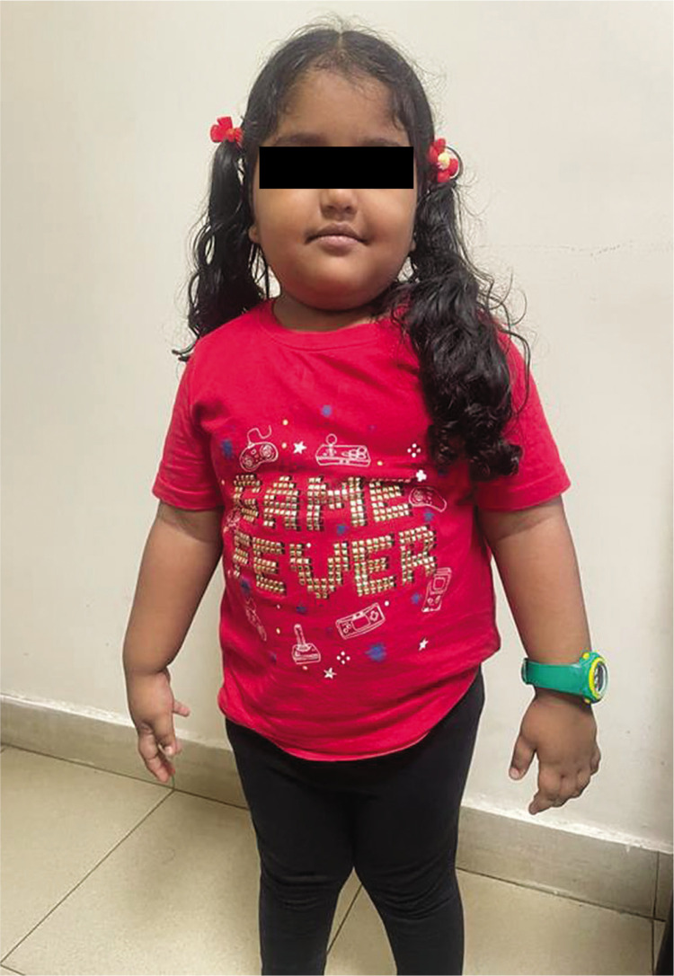 ROHHAD-NET Syndrome: A Case Series.
