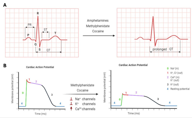 Heartbreakers: Decoding the Molecular Dynamics of Stimulants Abuse on the Cardiovascular System.