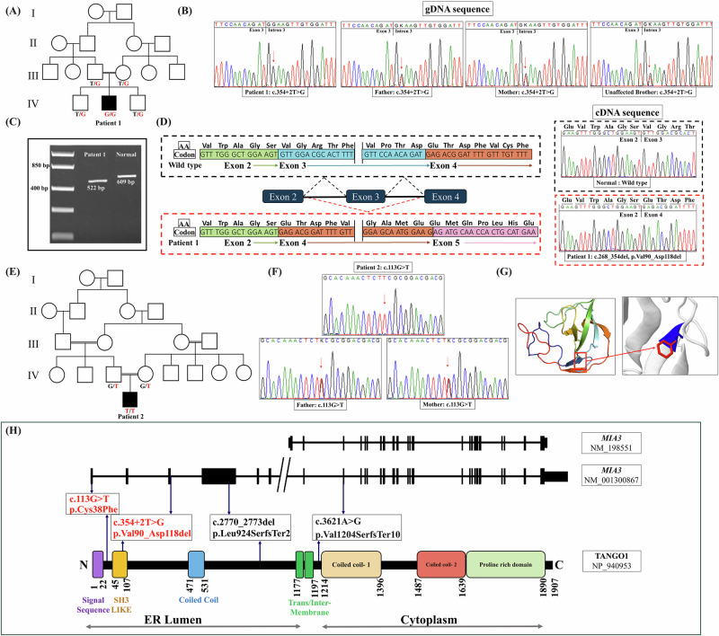 Deciphering the phenotypic spectrum associated with MIA3-related odontochondrodysplasia.