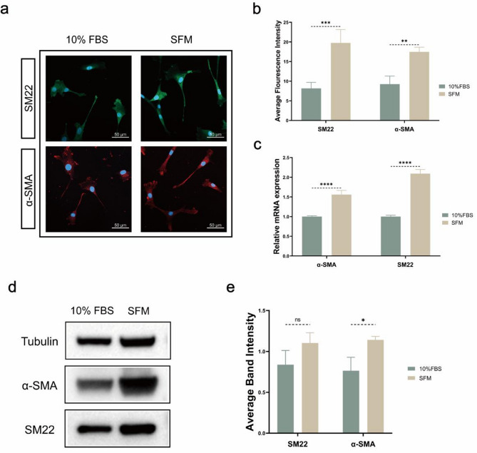 Serum-free endothelial cell culture medium for vascular smooth muscle cells sheet formation.