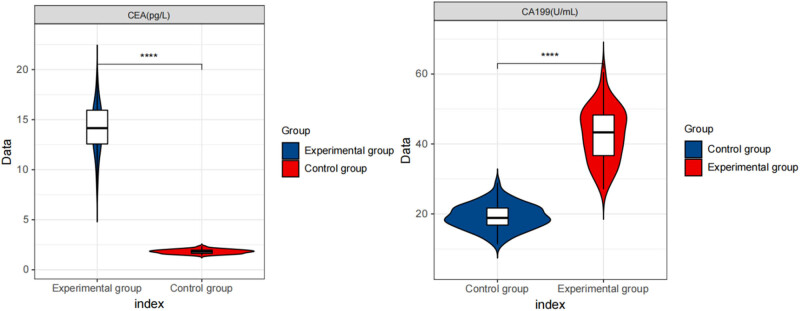 CA199 and CEA expression levels, and minimally invasive postoperative prognosis analysis in esophageal squamous carcinoma patients.