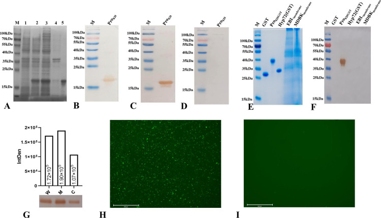 <i>MBOVJF4278_00820</i> encodes a novel cytoadhesin of <i>Mycoplasma bovis</i> binding to heparin.