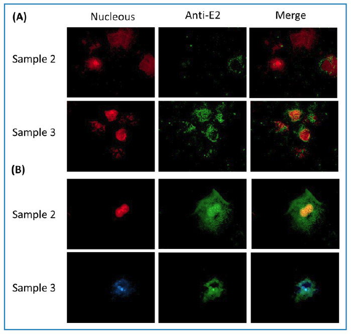 Persistent Cervical Infection with the Chikungunya Virus.