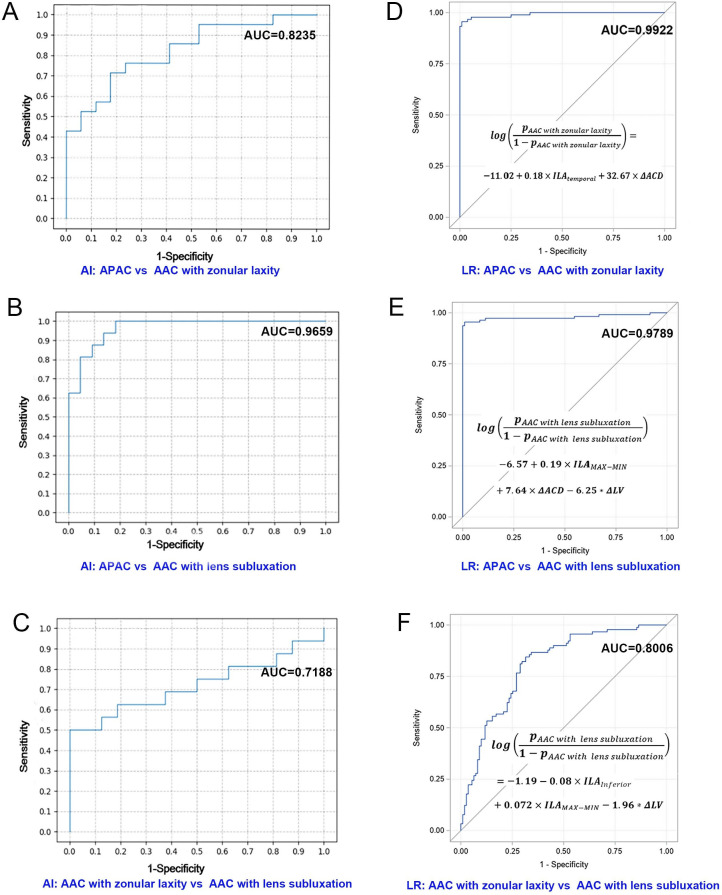 Deep learning-based automatic differentiation of acute angle closure with or without zonulopathy using ultrasound biomicroscopy: a comparison of diagnostic performance with ophthalmologists.