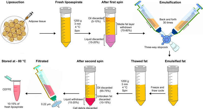 Core-shell nanofiber dressings with zinc oxide nanoparticles and cell-free fat extract: boosting fibroblast activity and antibacterial efficacy.