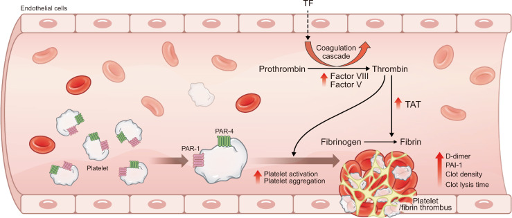 Metabolic Disorders and Inflammatory Bowel Diseases.
