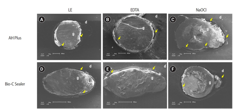 The effect of limonene extract on the adhesion of different endodontic cements to root dentin: an in vitro experimental study.