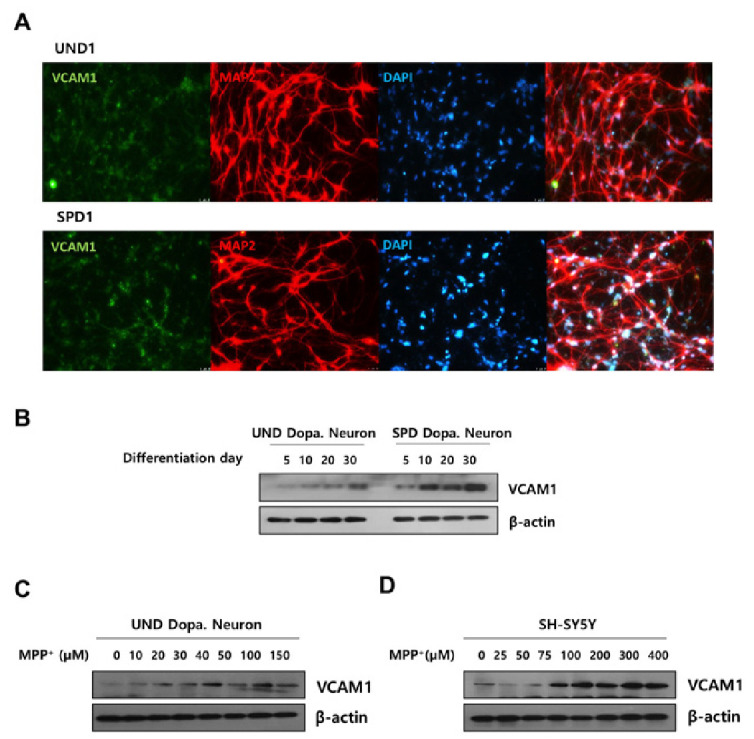 VCAM1-mediated regulation of dopaminergic neuron function in Parkinson's disease.