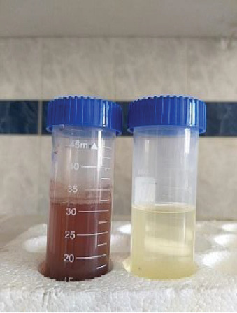 Eco-Friendly Synthesis and Characterization of <i>Senna italica</i>-Derived Silver Nanoparticles With Broad-Spectrum Antimicrobial Activity.