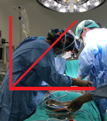 An Overlooked Hazard for Operating Room Nurses: Ergonomic Risks and Consequences Related to Working Position.
