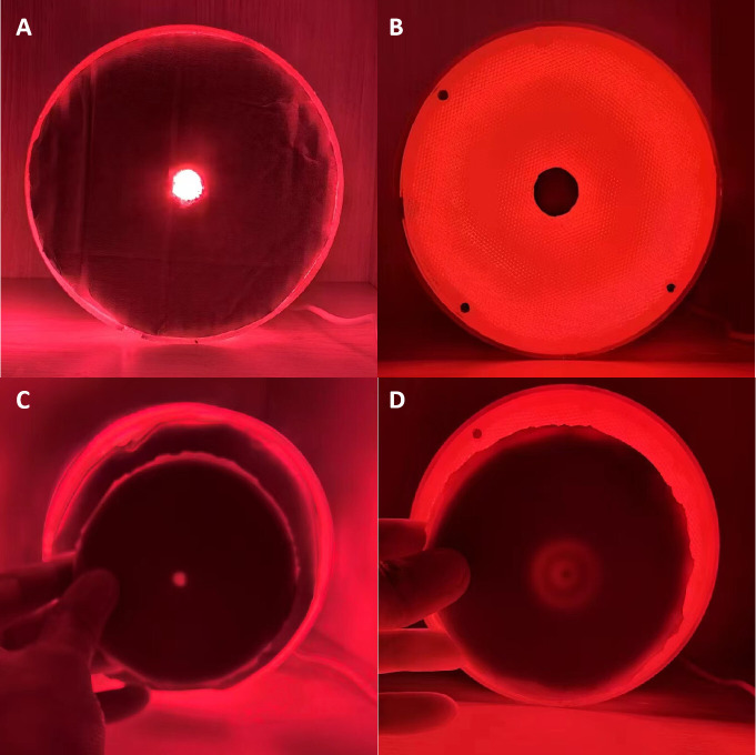 Peripheral retinal irradiation with low-energy red light can effectively and safely delay the progression of myopia.