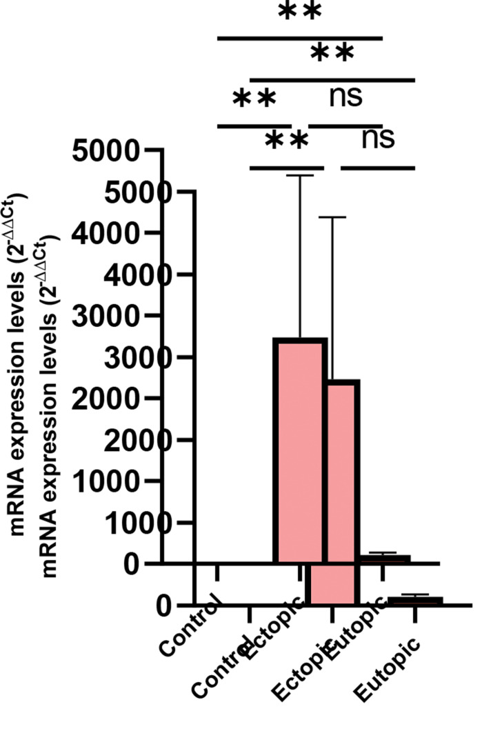 Drug Repurposing for Targeting ISL LIM Homeobox 2 in Treatment of Endometriosis: A Computational Study.