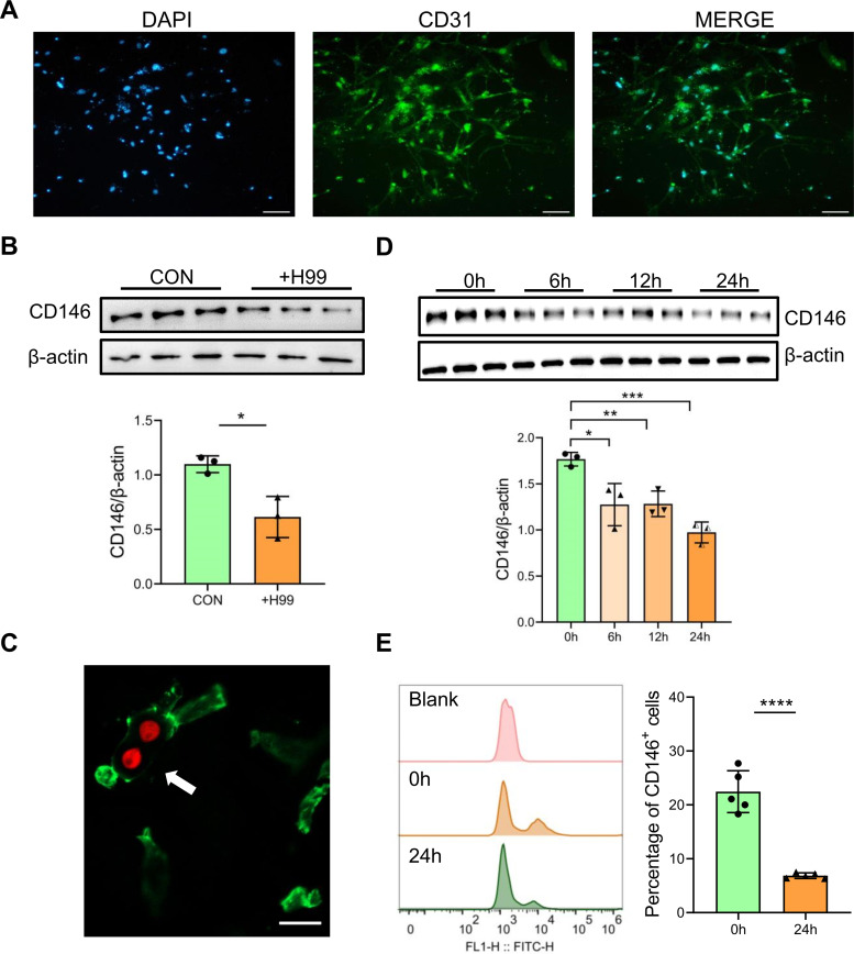 Involvement of CD146 in the <i>Cryptococcus neoformans</i> adhesion and infection of brain endothelial cells.