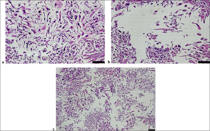 Diagnostic utility of cell block preparations from liquid-based cytology in cervical lesions: A comparative retrospective analysis.