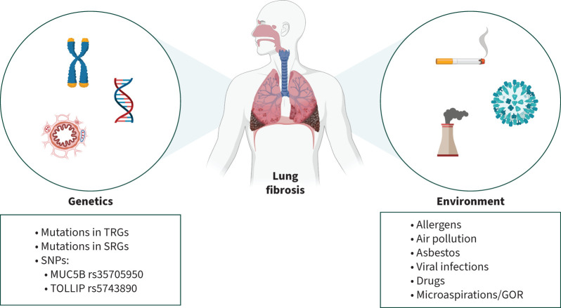 Insights into interstitial lung disease pathogenesis.