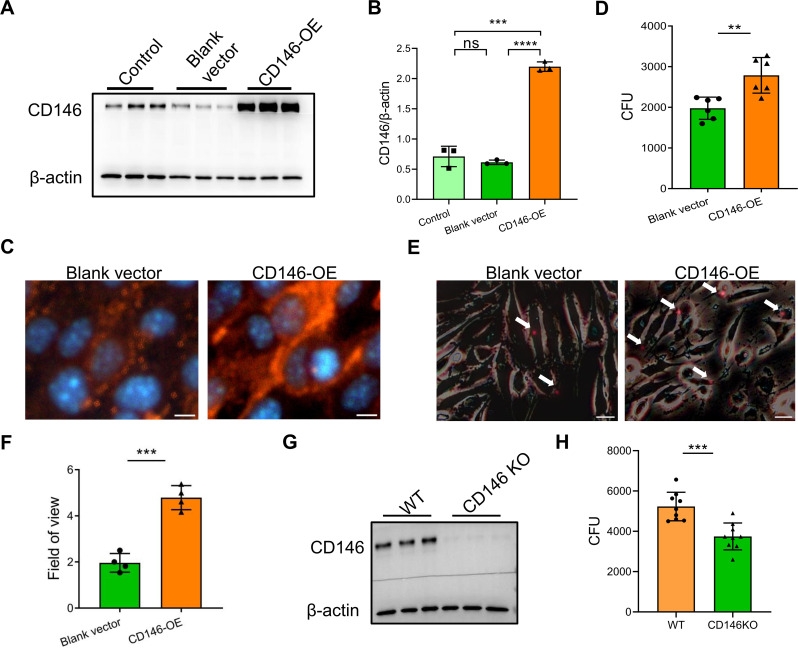 Involvement of CD146 in the <i>Cryptococcus neoformans</i> adhesion and infection of brain endothelial cells.