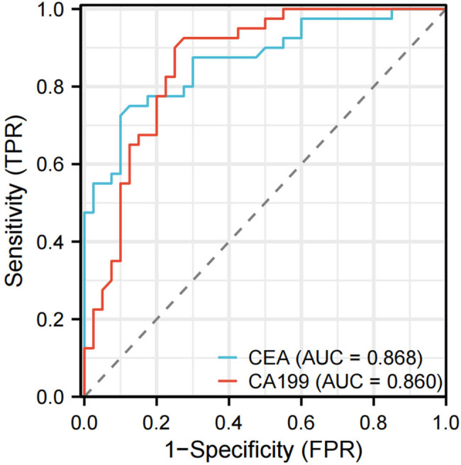 CA199 and CEA expression levels, and minimally invasive postoperative prognosis analysis in esophageal squamous carcinoma patients.