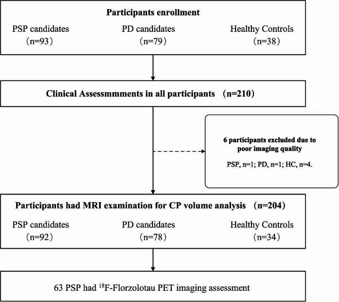 Choroid plexus enlargement correlates with subcortical tau deposition in progressive supranuclear palsy.