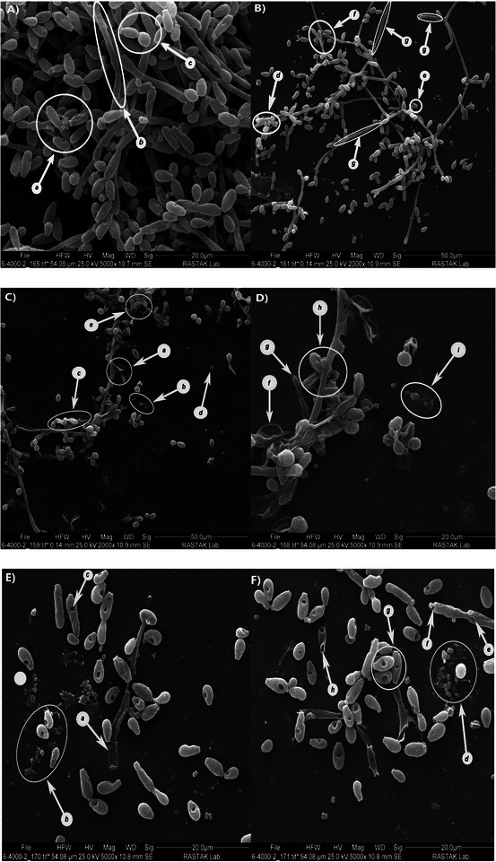 Evaluating the Antimicrobial and Antibiofilm Efficacy of Lavender Essential Oil and Linalool on Dual Candida albicans Biofilms With Staphylococcus aureus and Staphylococcus epidermidis From Canine External Otitis.
