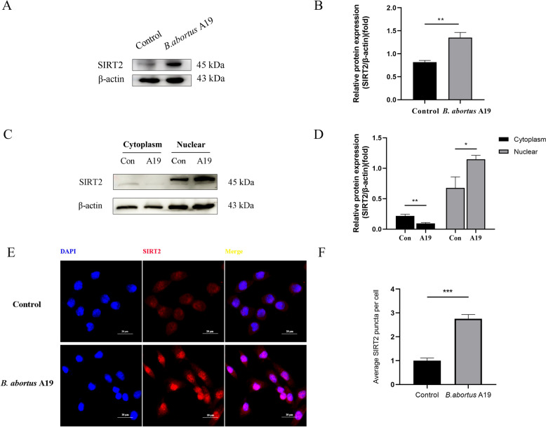 SIRT2 inhibition enhances mitochondrial apoptosis in Brucella-infected bovine placental trophoblast cells.