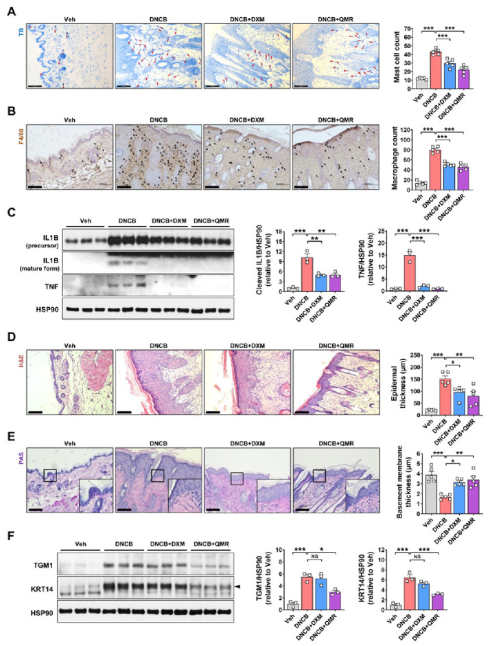 Quantum molecular resonance ameliorates atopic dermatitis through suppression of IL36G and SPRR2B.