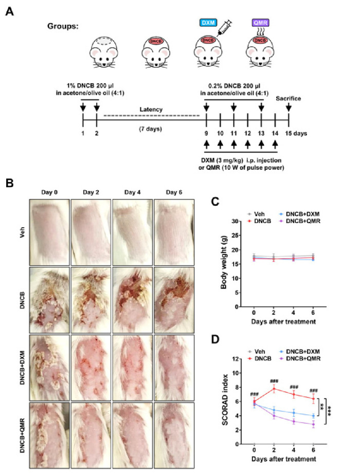Quantum molecular resonance ameliorates atopic dermatitis through suppression of IL36G and SPRR2B.