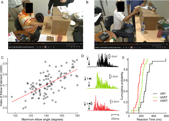 Association of a kinematic measure of upper limb reaching and StartReact in chronic hemiparetic stroke.