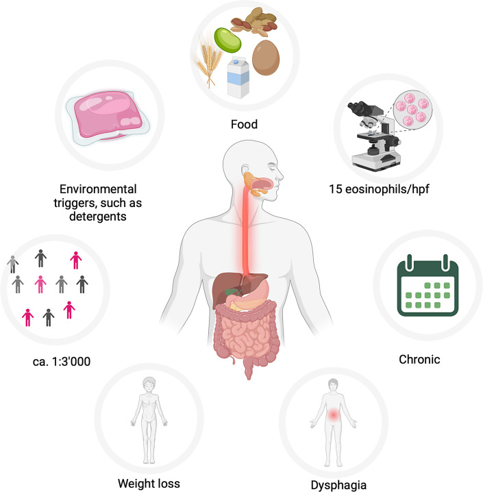 Eosinophilic Esophagitis Pathogenesis: All Clear?