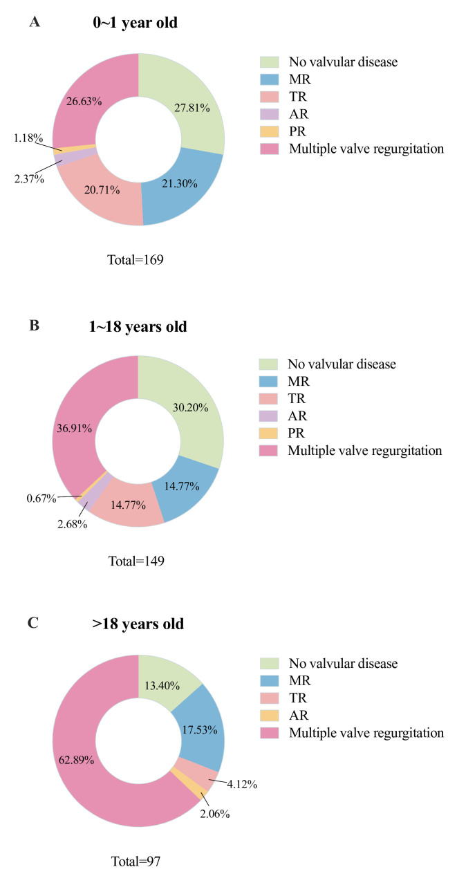 Clinical features of non-compaction cardiomyopathy across age groups: a retrospective study of 415 patients.