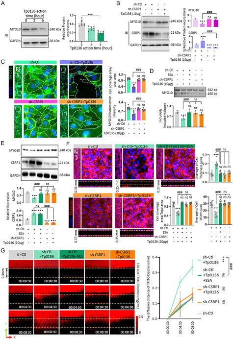 <i>Treponema pallidum</i> Protein Tp0136 Induces Spheroidization of Vascular Endothelial Cells, Resulting in Widened Intercellular Junctions and Enhanced Vascular Permeability.