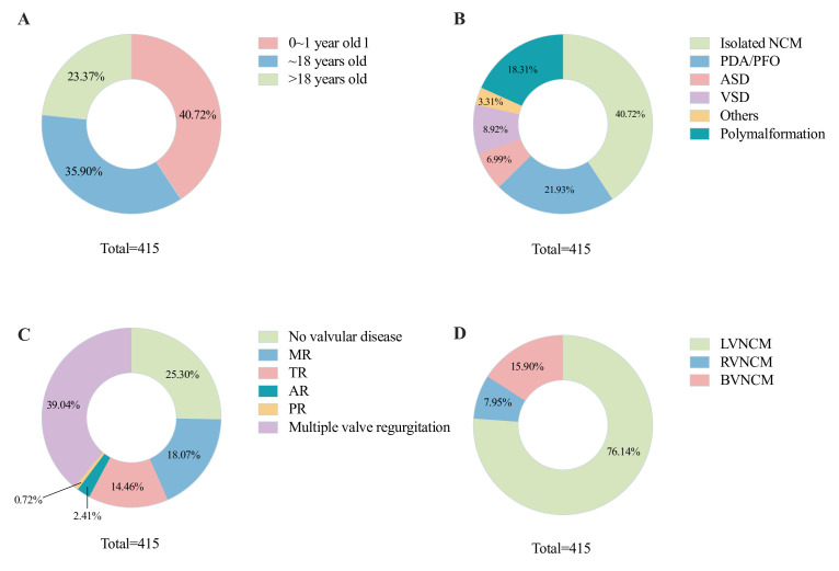 Clinical features of non-compaction cardiomyopathy across age groups: a retrospective study of 415 patients.