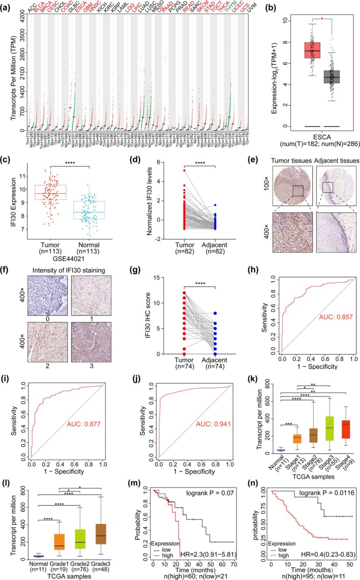 Correction to "IFI30 Knockdown Inhibits ESCC Progression by Promoting Apoptosis and Senescence via Activation of JNK and P21/P16 Pathways".