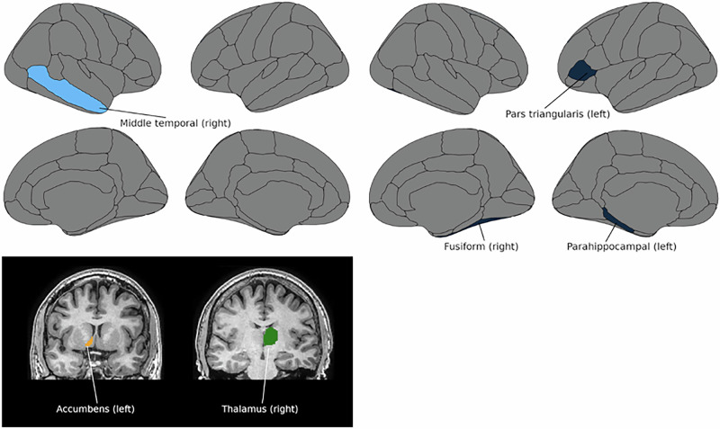 Toxoplasma gondii associated with psychotic symptom load and cortisol in severe mental illness.