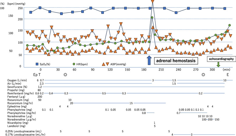 A case of abnormal hypertension and Takotsubo syndrome caused by adrenal hemostasis using an electric scalpel: a case report.