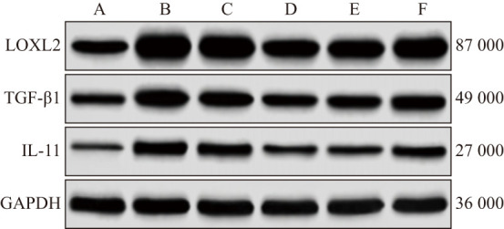 [Shenge powder inhibits myocardial fibrosis in rats with post-myocardial infarction heart failure through LOXL2/TGF-β1/IL-11 signaling pathway].