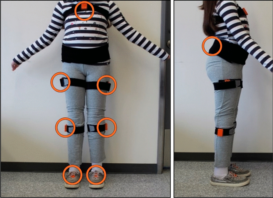 Hidden Markov model-based similarity measure (HMM-SM) for gait quality assessment of lower-limb prosthetic users using inertial sensor signals.