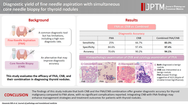 Diagnostic yield of fine needle aspiration with simultaneous core needle biopsy for thyroid nodules.
