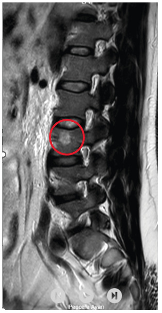 A Case of Doxycycline-Induced Esophagitis Accompanied by Oral Aphthous Ulcers and Laryngitis.