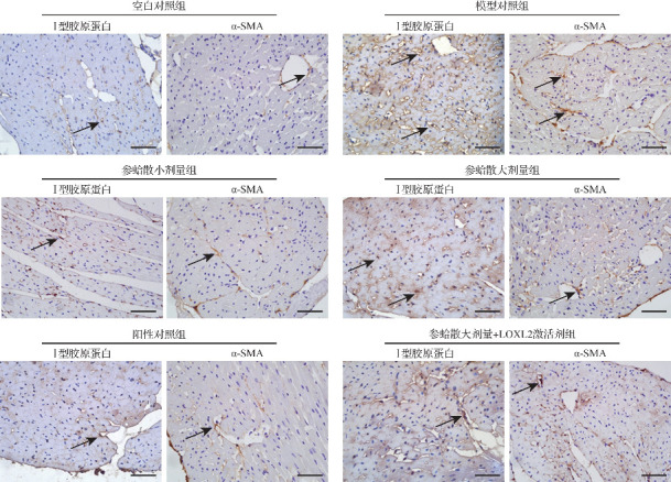 [Shenge powder inhibits myocardial fibrosis in rats with post-myocardial infarction heart failure through LOXL2/TGF-β1/IL-11 signaling pathway].