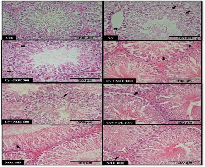 Preventive and therapeutic effects of <i>Nasturtium officinale</i> hydroalcoholic extract on cyclophosphamide-induced testicular toxicity in rats.